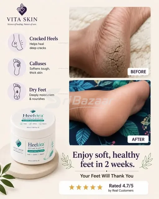 Heelora Cracked Heel & Dry Foot Cream